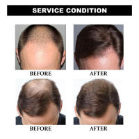 EAST MOON Care Follicles hidrata y nutre las raíces, esencia reafirmante para cabello denso y resistente. - details 7