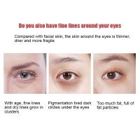 Crema de Ojos anti-arrugas Retinol Cuidado de la Piel para Elenes Elimina Ojeras y Bolsas - details 4