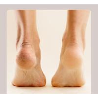 Electric foot scrubber: Rechargeable exfoliator that removes calluses and leaves feet smooth, suitable for home or travel use - details 2