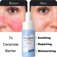 7X suero calmante para enrojecimiento Facial, tratamiento instantáneo de rosácea, venas de sangre rojas, mejora la reparación de la barrera de la piel sensible, cosméticos Coreanos - details 2