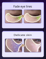 Masajeador de Ojos de terapia de luz roja EMS, compresa caliente, elimina las ojeras, relaja los ojos cansados, antiarrugas, estiramiento facial, cuidado de los ojos, varita de belleza - details 7