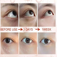 Crema para los Ojos Removedor de Granulos de Grasa Mejora la Firmeza y Iluminación - details 5