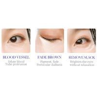 Suero de Ojos Firmador Anti-Hinchazón Reductor de Granos de Grasa Desvanece Ojeras - details 11