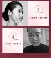 Dispositivo de elevación, terapia de fotones LED, masajeador adelgazante, masajeador de vibración facial calentado con doble mentón en V - details 5