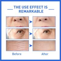 Solución en stock antiarrugas, diluye las líneas finas y las manchas oscuras de la piel, hidrata, rejuvenece y previene el envejecimiento. - details 10