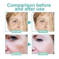 Crema Blanqueadora Potente Elimina Manchas de Melanina Rápido Hidrata y Ilumina la Piel - details 7
