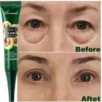 Crema para ojos para apretar arrugas, 7 días, línea fina, blanquea la piel debajo de los ojos, cuidado coreano, antiojeras, bolsas, hinchazón, se desvanece, nuevo 2024 - details 0