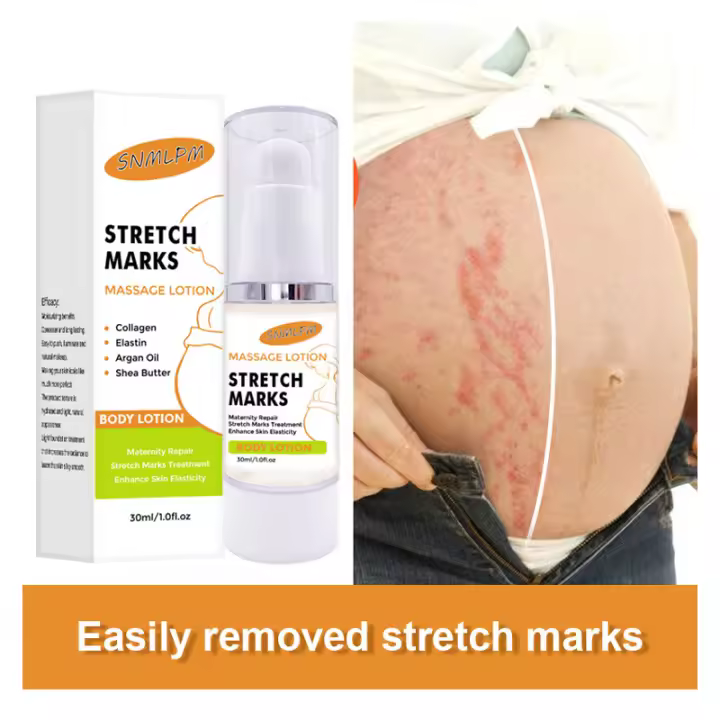 Crema para eliminar cicatrices de embarazo, crema para el acné, tratamiento de estrías, reparación de maternidad, cicatriz, línea holgada, crema para estrías del Abdomen - 1