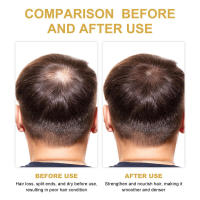 Romero para limpiar el cabello, controlar la grasa, raíces voluminosas, refrescante y nutritivo, prevención de la caída del cabello, champú suave - details 4