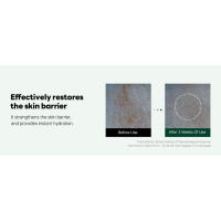 repair serum, acne-prone skin, calming, redness care, soothing, clean, glass skin, korean skincare