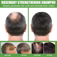 Champú de romero para el crecimiento del cabello, limpieza profunda, tratamiento del cuero cabelludo, Control de aceite, fortalecimiento de las raíces del cabello, champú antipérdida de cabello, 100ml - details 6