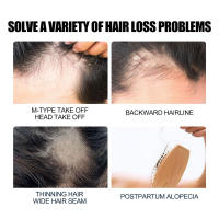 Esencia para reparar la hidratación de raíces dañadas, cabello denso, pérdida de cabello y aceite esencial antifrizz - details 5