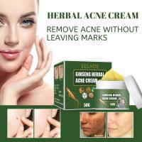 EELHOE-crema de tratamiento de Ginseng a base de hierbas, Reduce las cicatrices, Control de aceite, hidratante, reduce los poros naturales, loción facial para el acné - details 0