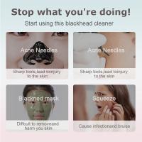 Kit de Vacío para Eliminar Puntos Negros Herramienta Extractora de Pores con 3 Niveles de Succión, 5 Probos, Recargable por USB, Adecuado para Mujeres y Hombres - details 4