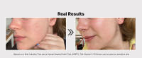 skin irritation test real results used on all skin types sensitive skin hript clinically tested