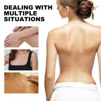 Loción corporal iluminadora para rodillas, blanqueamiento de muslos, nutritiva, elimina la melanina, hidratante, mejora la opacidad de la piel, crema corporal blanqueadora - details 4