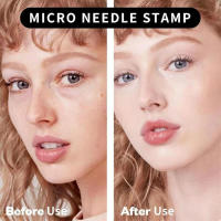 Derma Stamp Ajustable de 0-3mm Dermaroller de 140 Agujas Microagujas para Mujeres y Hombres - details 2
