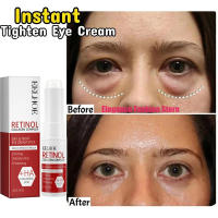 Crema para Eliminar Bolsas en los Ojos Instantánea Reduce Grasa, Desvanece Ojeras, Ilumina y Levanta Cuidado de Belleza Coreano - details 3