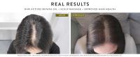Combat Hair Loss and Promote Fuller, Thicker Hair Powered by antioxidants and essential fatty