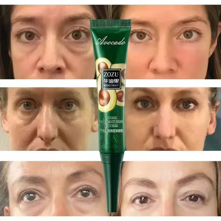Crema para Ojos de Cuidado Coreano Reducción de Arrugas, Blanqueo de Piel Debajo de los Ojos, Desvanecimiento de Hinchazón, Adiós a las Ojeras Herramientas de Cuidado de la Piel Facial Nuevas 2024 - 1