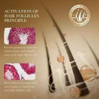 Aceite esencial para el crecimiento, reparación de la calvicie, síntomas antipérdida, promueve un suero para el cabello más grueso y fuerte - details 7