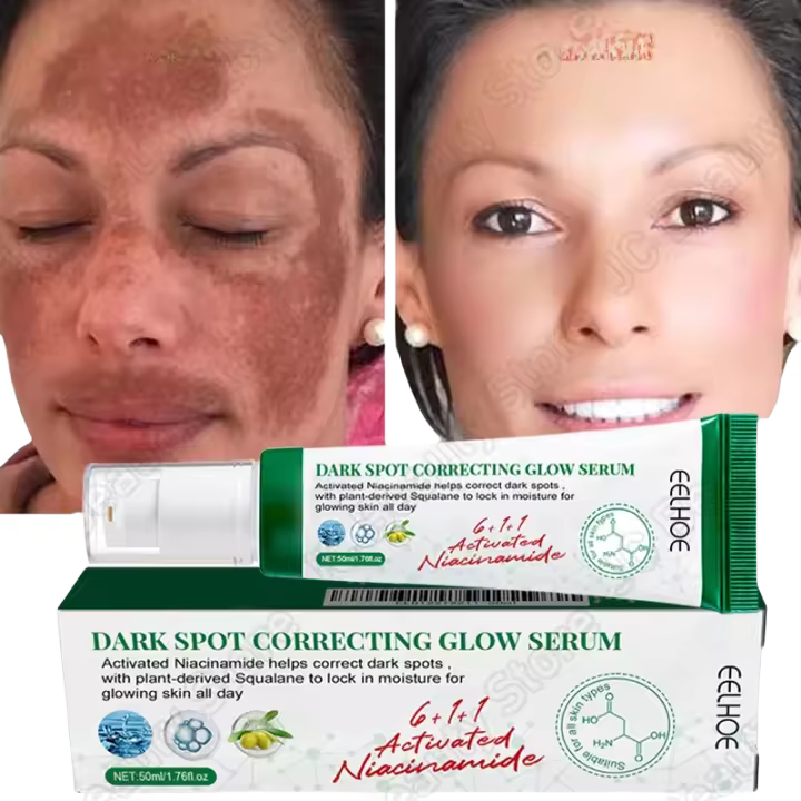 Suero Blanqueador Corrector de Manchas Dark Spots Iluminador de Piel Cuidado de Belleza Coreano - 1