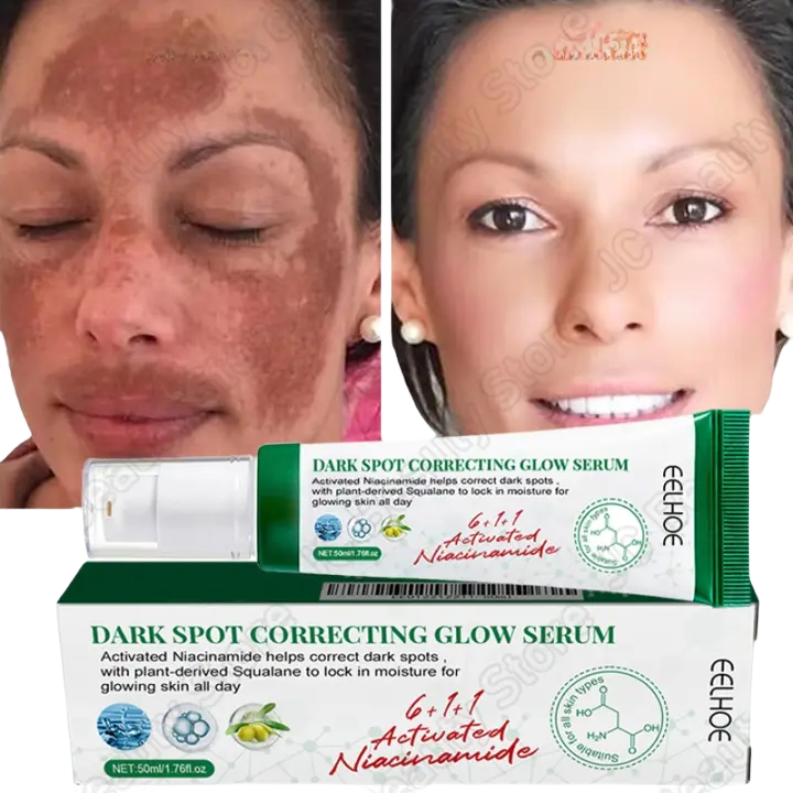 Suero Blanqueador Corrector de Manchas Dark Spots Iluminador de Piel Cuidado de Belleza Coreano - 1