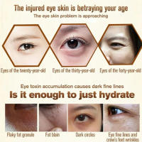 Suero de Ojos Firmador Anti-Hinchazón Reductor de Granos de Grasa Desvanece Ojeras - details 6