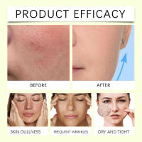 Crema nutritiva hidratante con mantequilla y miel OCEAURA hidrata profundamente la piel, mejora la sequedad y nutre suavemente el rostro. - details 6