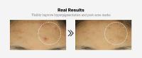 real results acne hyperpigmentation good for skin texture hydrate firm dry dull fine lines wrinkles