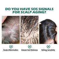 Limpia profundamente, repara las raíces del cuero cabelludo, alivia la picazón, previene la caída y solidifica el aceite esencial para el cuidado del cabello. - details 6