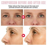 Crema de Adiós a las Ojeras Colágeno Anti-Arrugas para Reafirmar la Piel - details 5