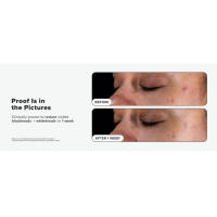 Paula's Choice SKIN PERFECTING 2% BHA Exfoliante líquido de ácido salicílico-exfoliante facial para puntos negros, poros agrandados y arrugas - details 7