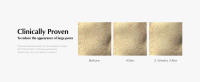 Pore Cleansing 2