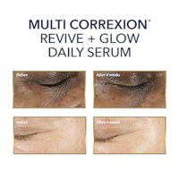 RoC Vitamin C Serum Before and After