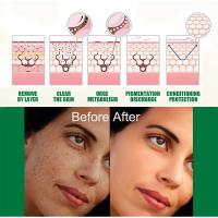 Suero corrector de manchas oscuras, crema blanqueadora hidratante para la piel Facial, Reduce las pecas, la opacidad, el acné y la melanina - details 11