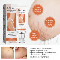 Desaliniza el cuerpo, reparación de cicatrices de embarazo, crema suave y nutritiva para el cuidado de la piel - details 4