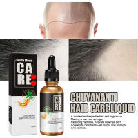 Aceite esencial de South Moon, esencia para el cuero cabelludo, cuidado del cabello, líquido de masaje nutritivo - details 3