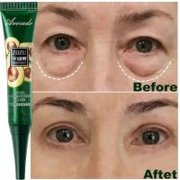 Crema de Ojos para Bujías Instantáneas Reducción de Arrugas, Desvanezimiento de Hinchazón, Reafirmación de Piel Blanca Bajo los Ojos Herramientas de Cuidado de la Piel Facial - details 1