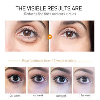 Crema Antideslumbramiento para Ojos Serum Antiedad para Eliminar Ojeras, Cirros, Hinchazón - details 2