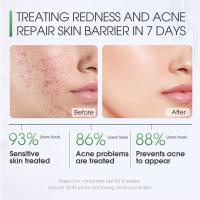 Centella tónico calmante reparación tónico Facial Centella calmante hidratante reparación loción para la piel esencia Control de aceite cara agua - details 6