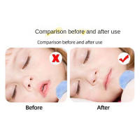 30 unids/set previene la boca abierta para dormir, parche para respirar la boca, corrección Mandibular, cinta bucal antironquidos para niños - details 4
