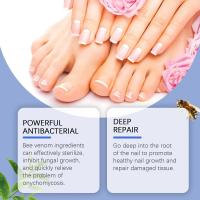 Solución para el cuidado de las uñas, Esencia para el cuidado de los hongos, Eliminación de la tiña, Gel antimicótico - details 1