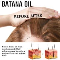 Suero de crecimiento rápido de aceite de Batana, productos antipérdida para el crecimiento, reparación de raíces dañadas, cuidado del cabello para mujeres y hombres, 7 días - details 8