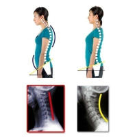 Corrector de Postura de Terapia Ajustable Soporte de Hombros y Espalda - details 20