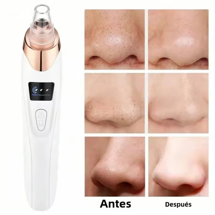 Máquina Exterminadora de Piel Profunda Limpiadora Eléctrica de Poros para Todas las Edades - 1
