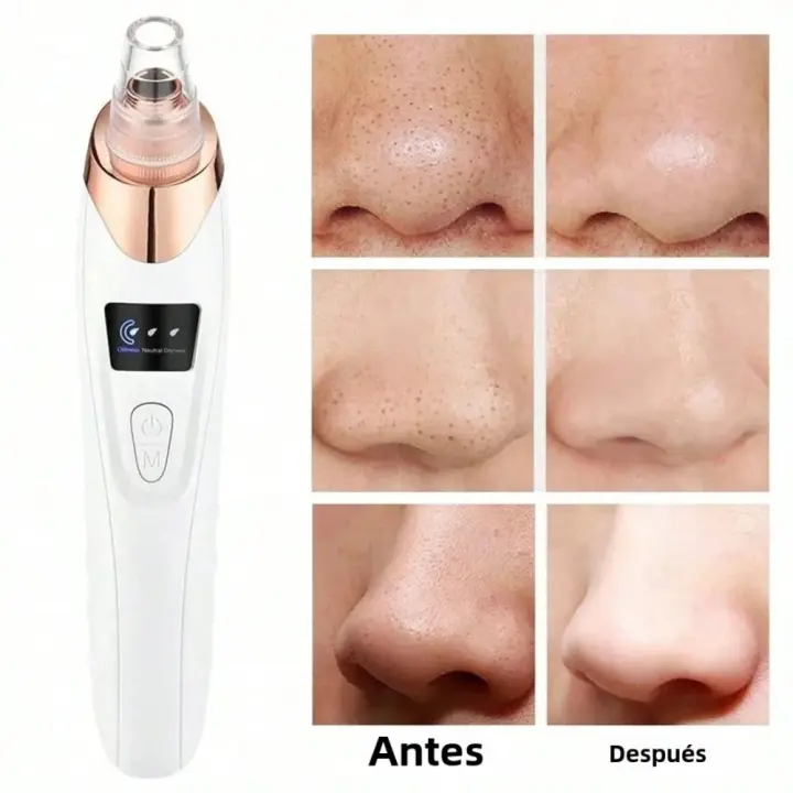 Máquina Exterminadora de Piel Profunda Limpiadora Eléctrica de Poros para Todas las Edades - 1