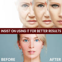 Crema para eliminar manchas blanqueadoras de Ácido Kójico, elimina el melasma, corrección de melanina, mejora la piel, aclara las manchas oscuras, cosméticos - details 2