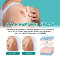 Spray para eliminar cicatrices, cuidado de cicatrices, Reduce la formación de cicatrices, cicatrices que se desvanecen, cicatrices de acné, cicatrices quirúrgicas y estrías, Spray para eliminar cicatrices - details 12