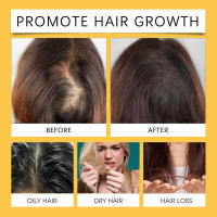 La esencia para el cuidado del cabello nutre el cuero cabelludo, haciendo que sea fuerte, hermoso, radiante, suave y brillante. - details 8